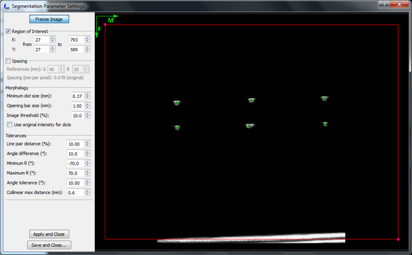 UltrasoundImageOrientationsSegParamWindow.png